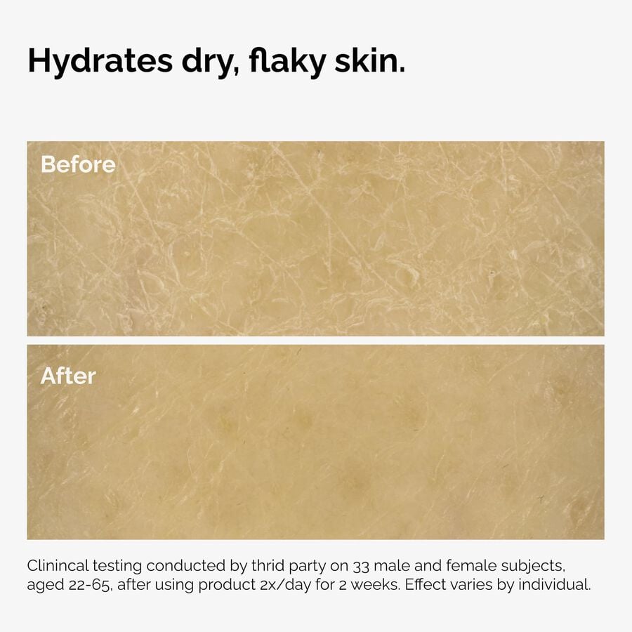 the-body-care-collection-j3 ord-natural-moisturizing-factors-inulin-body-before-after-graphic-02.jpg