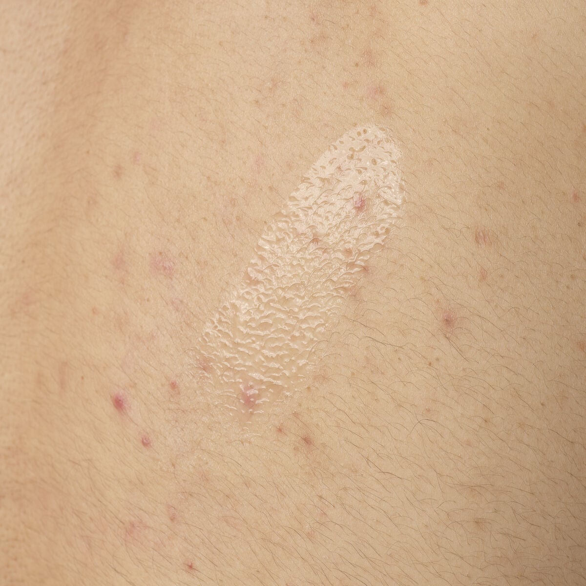 salicylic-acid-0-5-body-serum-g7 ORD-salicylic-acid-05-body-240ml-application.jpg