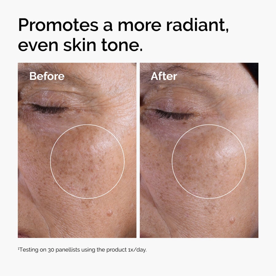 glycolic-acid-7-exfoliating-toner-g4 ord-glycolic-before-after-radiance.jpg