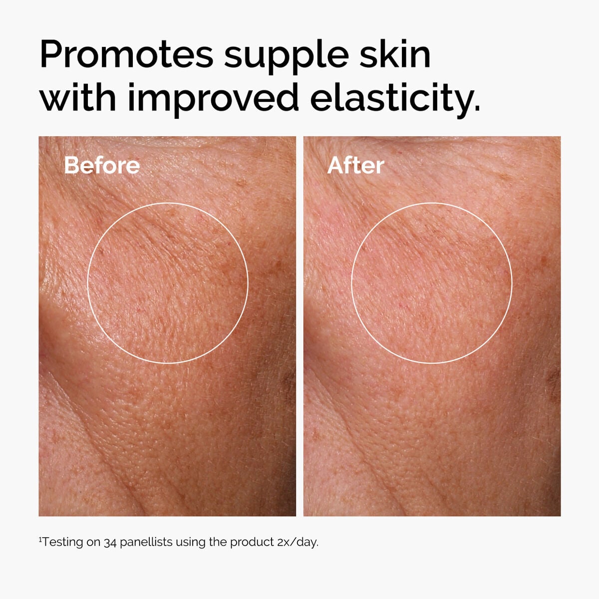 hyaluronic-acid-2-b5-with-ceramides-u7 ord-hyaluronic-acid-2pct-b5-hydrating-serum-before-after-elasticity.jpg