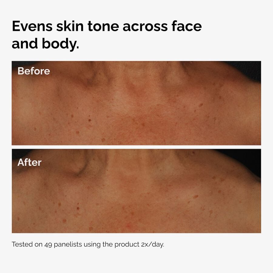 the-body-care-collection-j3 ord-niacinamide-face-body-serum-before-after-even-tone-graphic.jpg