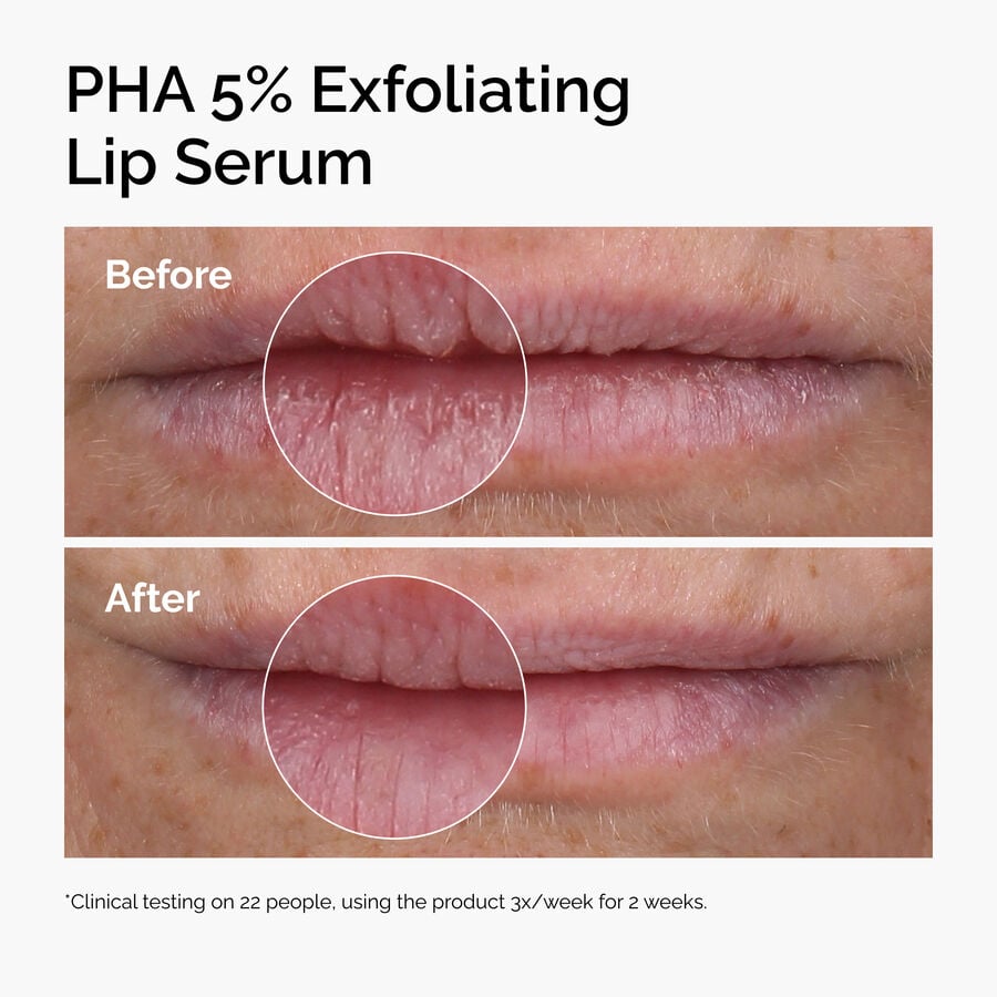 pha-5-exfoliating-lip-serum-b4 ord-pha-5pct-lip-exfoliating-serum-before-after.jpg