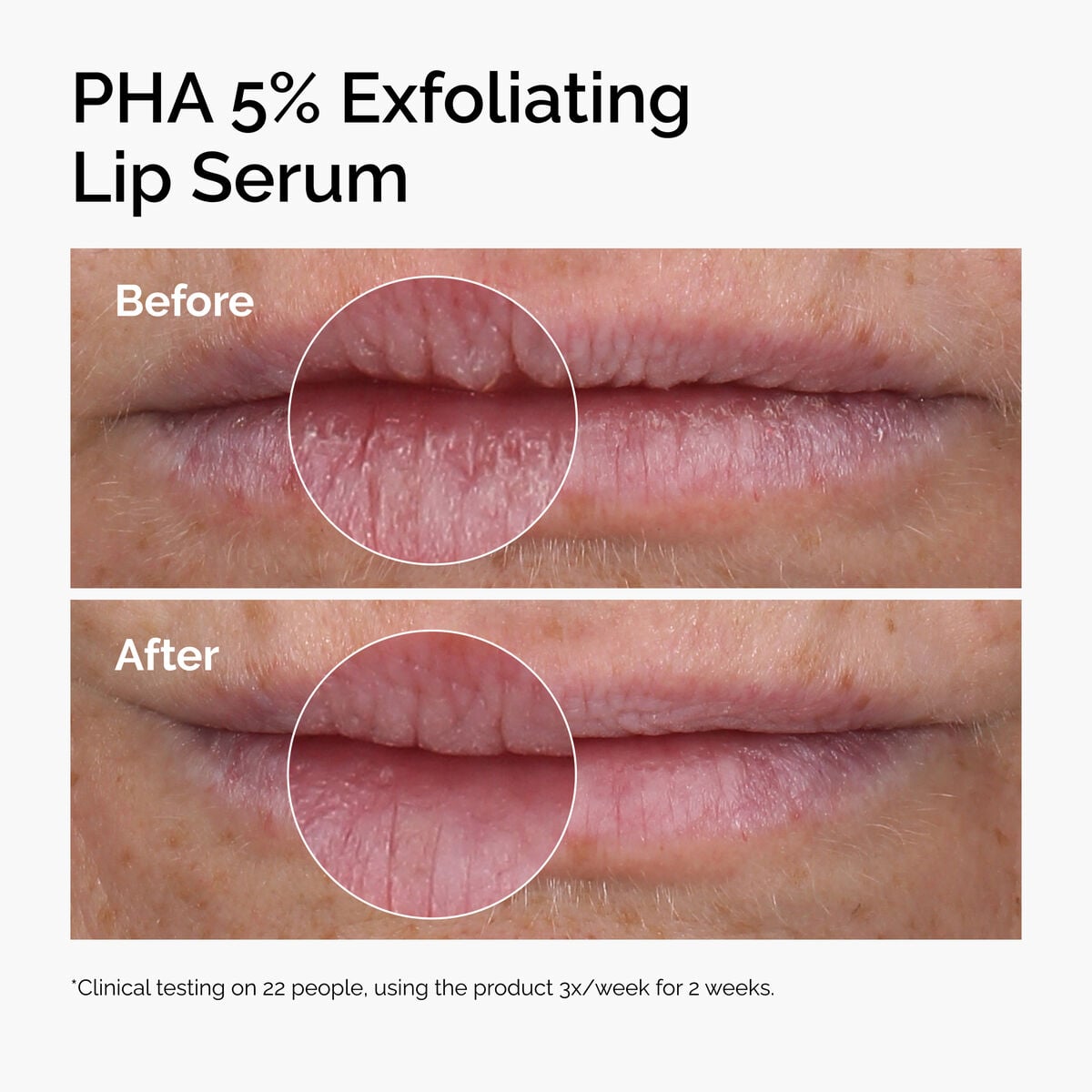pha-5-exfoliating-lip-serum-b4 ord-pha-5pct-lip-exfoliating-serum-before-after.jpg