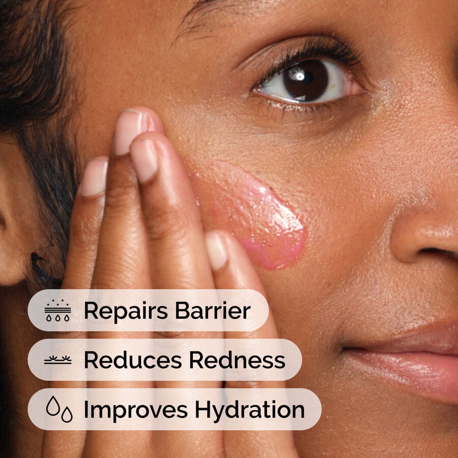 soothing-and-barrier-support-serum-r7 ord-soothing-barrier-support-serum-model-application-with-benefits.jpg